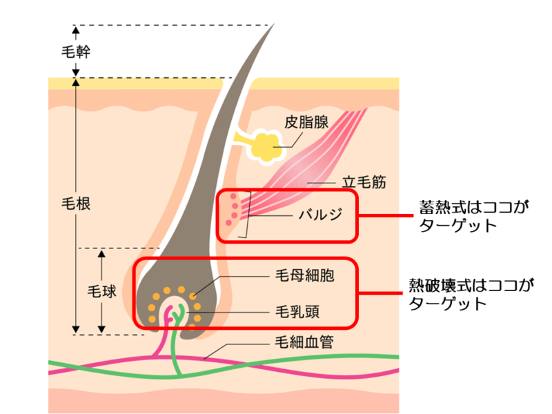 蓄熱式、熱破壊式